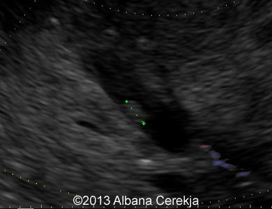 04-embryo-and-color