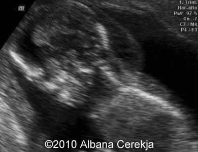 13wks