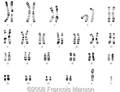 trisomy karyotype