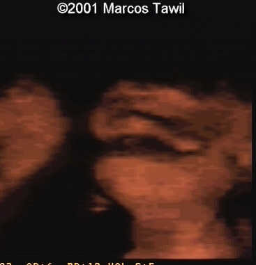 2393