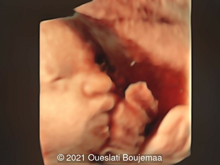 Case Of The Week 552