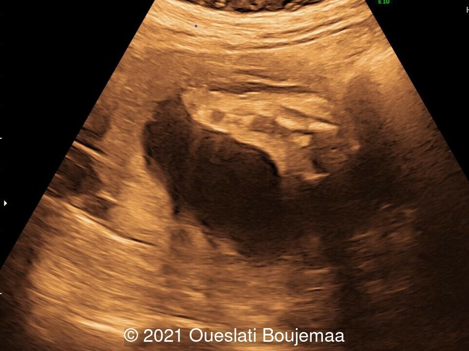 Case Of The Week 552