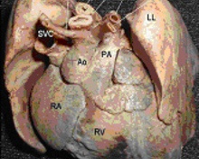 Superior vena cava-aortic arch-pulmonary artery and trachea image