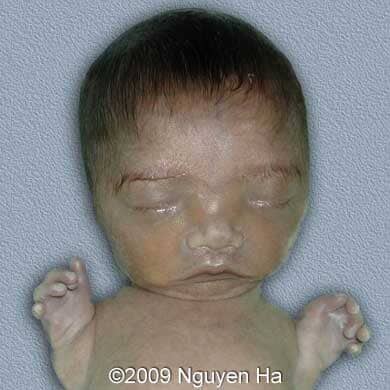 Case of the Week # 238