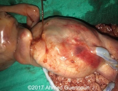 Abdomen Postnatal appearance