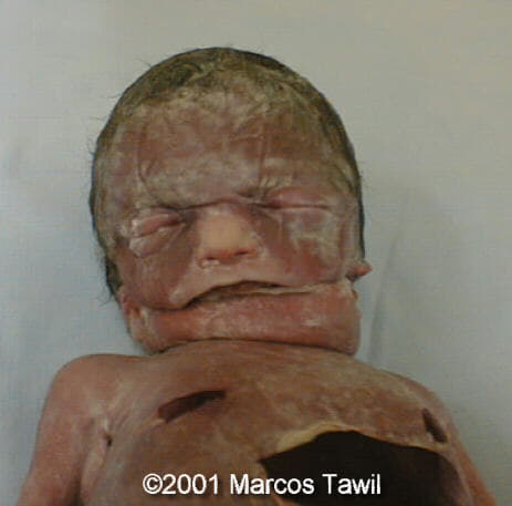 baby2
