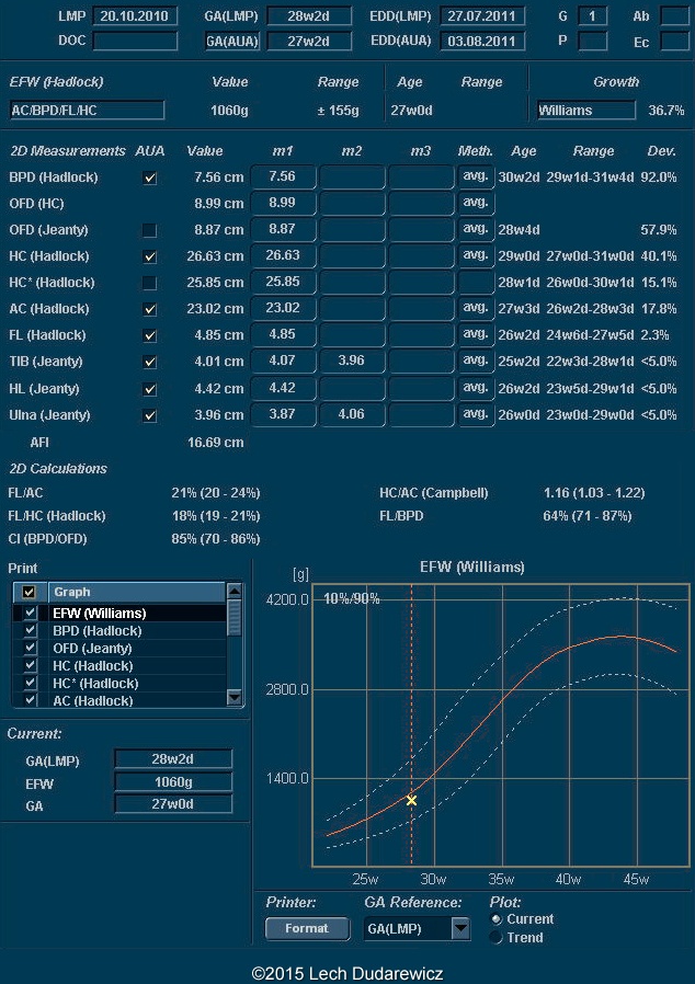 Biometry