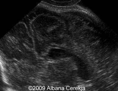 case-1-again-sag-scan-with-