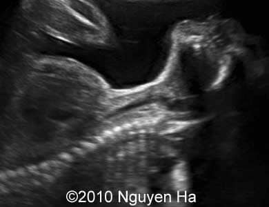 Case_277_1