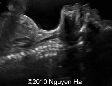 Case_277_2
