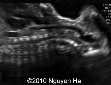Case_277_4