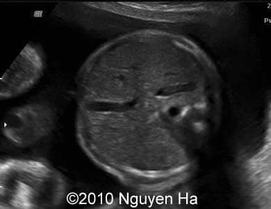 Case_277_7