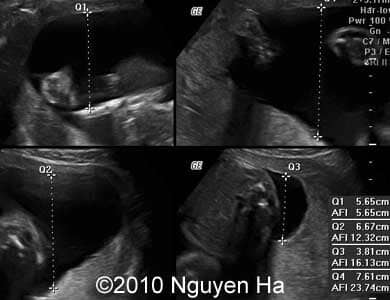 Case_277_8