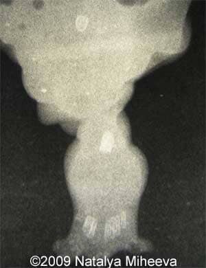 Case of the Week # 265