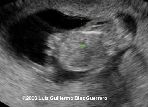 case0019-2