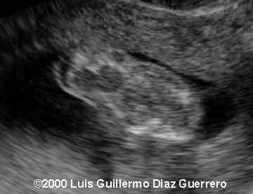case0019-4