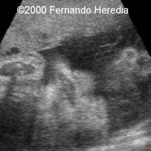 case0038-1