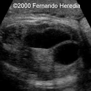 case0038-11