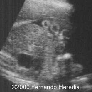 case0038-12