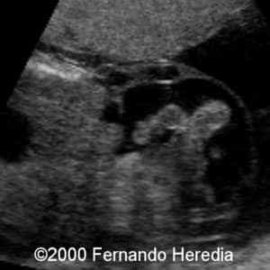 case0038-13