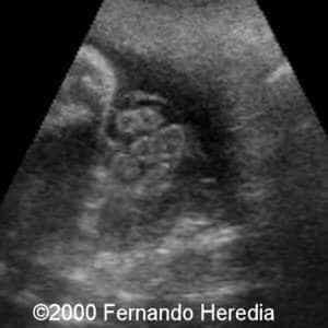 case0038-14