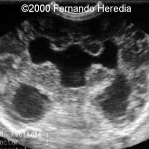 case0038-16