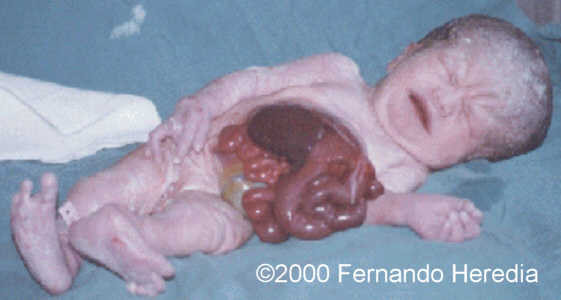 case0038-21
