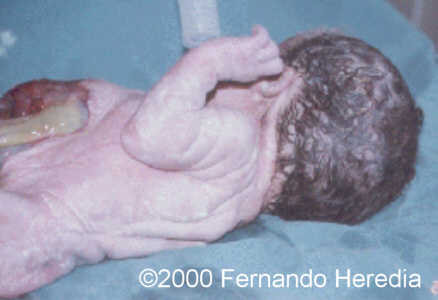 case0038-22