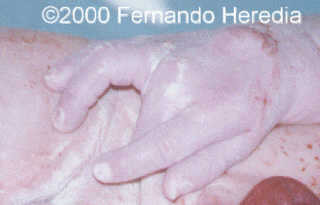 case0038-25