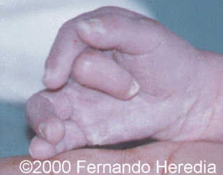 case0038-27