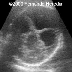 case0038-4