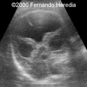 case0038-5