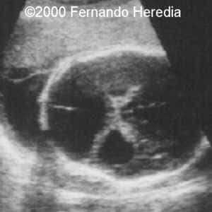 case0038-6