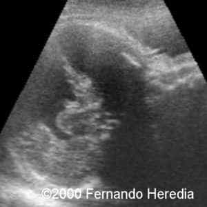 case0038-7