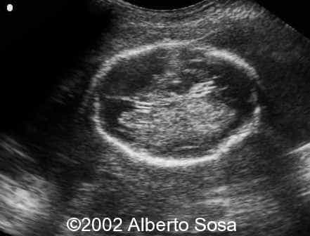 case0091-1