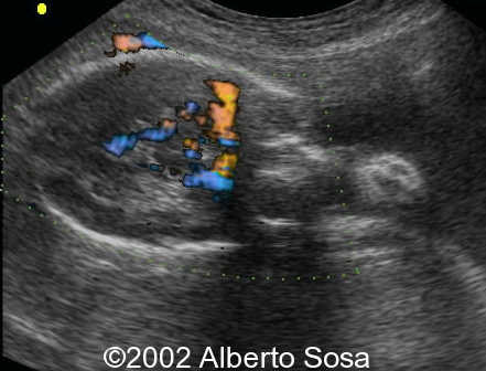 case0091-12