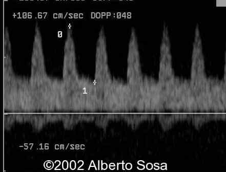 case0091-13