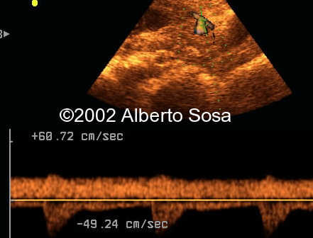 case0091-14