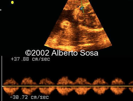 case0091-15