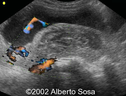 case0091-16