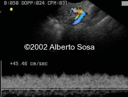case0091-17