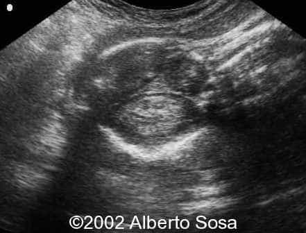 case0091-2