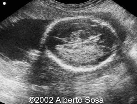 case0091-3