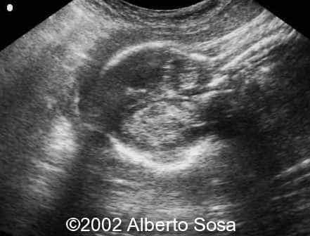 case0091-4