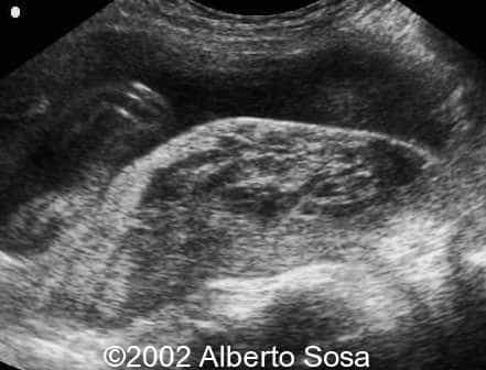 case0091-5