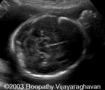 case0097-01