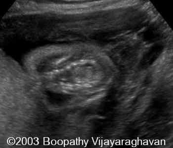 case0097-04