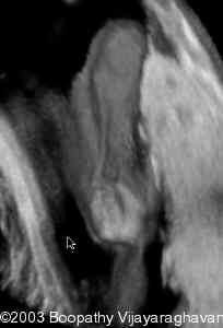 case0097-05