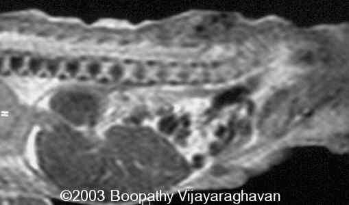 case0097-07