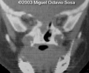 case0101-10